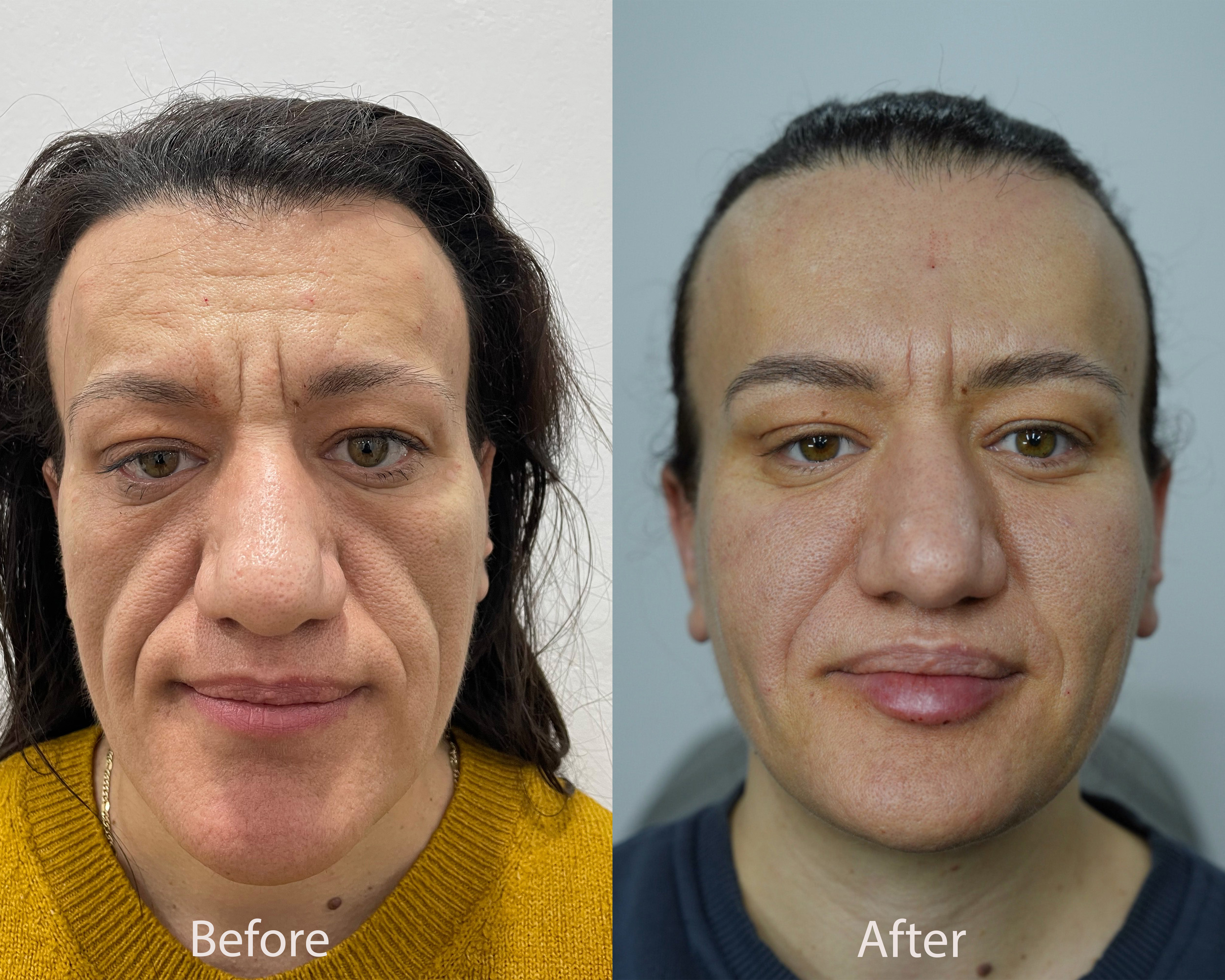 Transformation